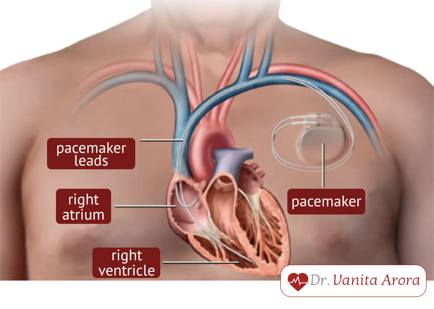 Best Cardiologist in West Delhi