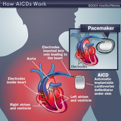 arrhythmia specialist