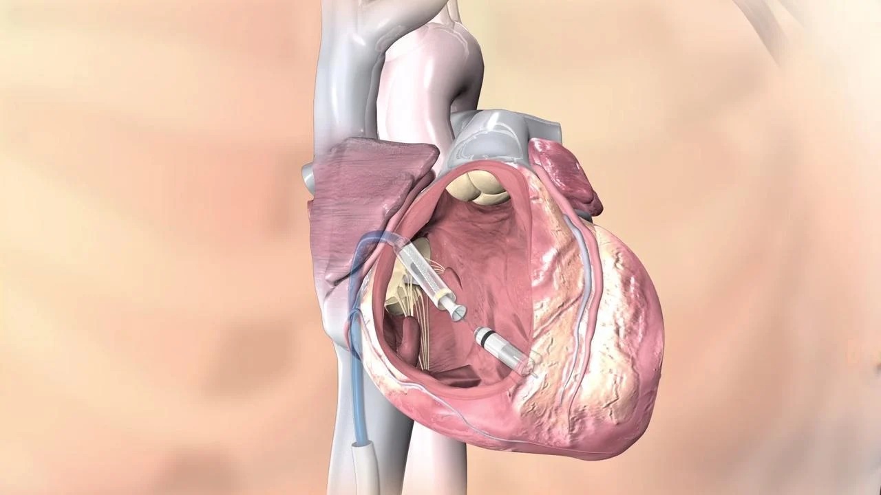 Heart Specialist in India: Why Indian Cardiology is Gaining Global Recognition