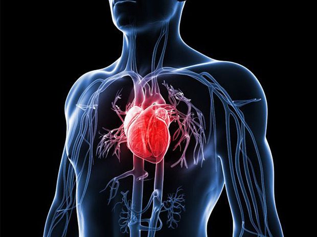 Signs & Symptoms of a Heart Attack