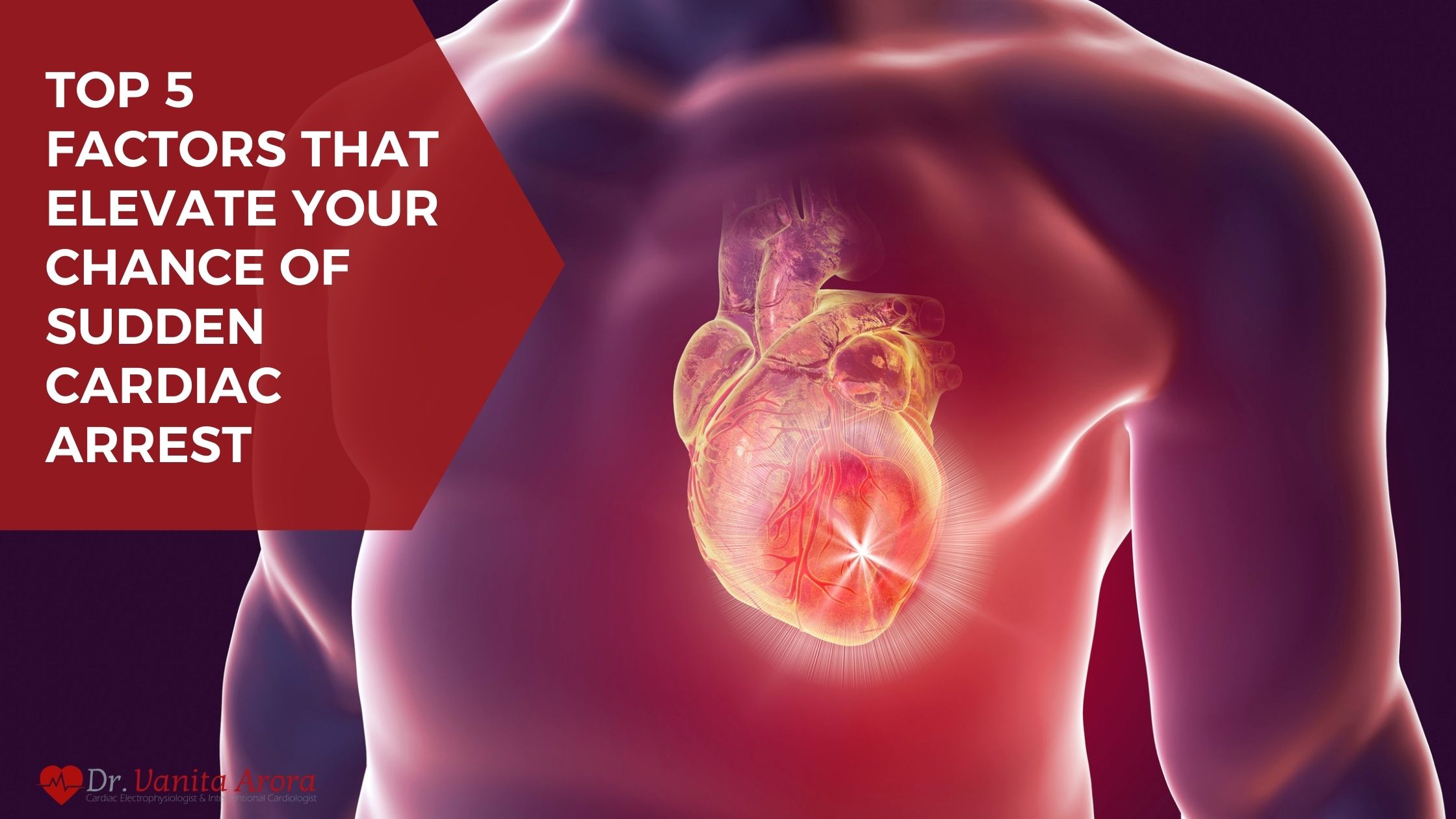 Top 5 Factors that Elevate Your Chance of Sudden Cardiac Arrest